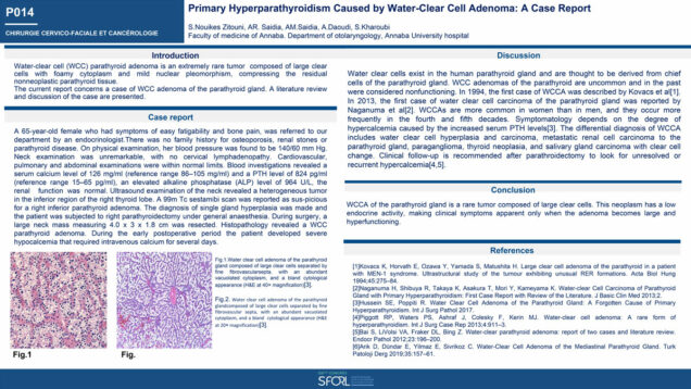 464_ZITOUNI_SOUAD_P014-Hyperparathyroidie-primaire-due-a-un-adenome-a-cellules-claires-a-propos-dun-cas