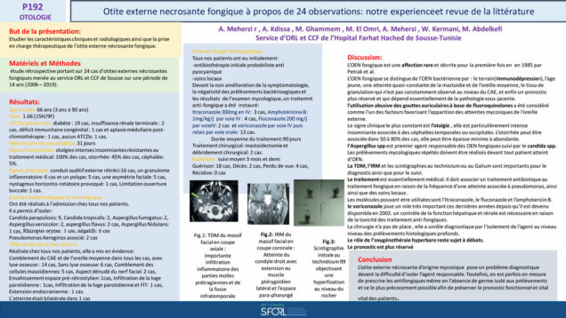 643_Meherzi_Abir_P192-LES-OTITES-EXTERNES-NECROSANTES-DORIGINE-FONGIQUES-difficulte-diagnostique-et-principes-therapeutiques