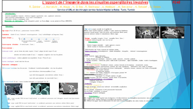 700_moula_marwa_P248-Apport-de-limagerie-dans-les-sinusites-aspergillaires-invasives