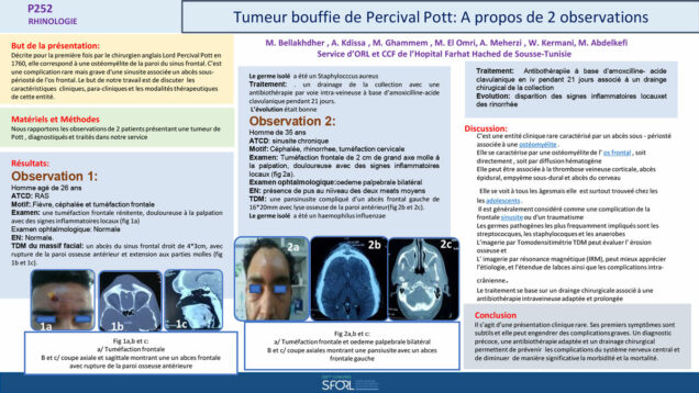 704_Kdissa_Amal_P252-Tumeur-bouffie-de-Percival-Pott-A-propos-de-2-observations