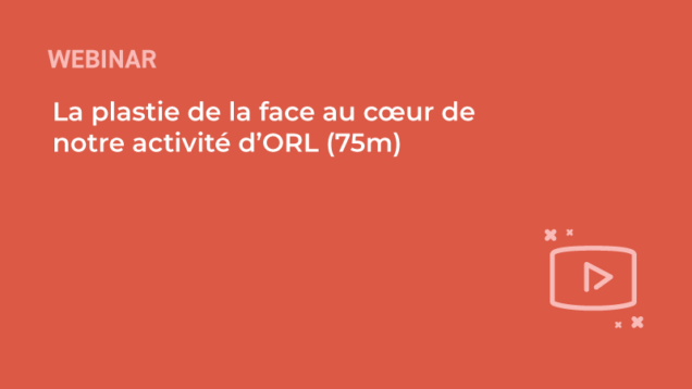 SFORL_VIEWR_-template-vignettes-replay