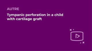 SFORL_VIEWR_video_vignettes-COMMUNAUTEORL150