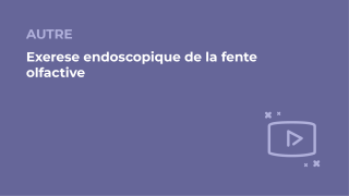 SFORL_VIEWR_video_vignettes-COMMUNAUTEORL162