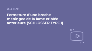 SFORL_VIEWR_video_vignettes-COMMUNAUTEORL163