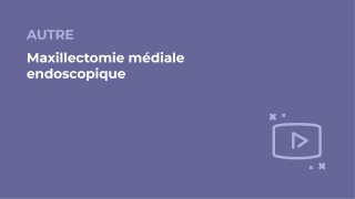 SFORL_VIEWR_video_vignettes-COMMUNAUTEORL175