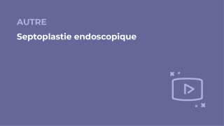 SFORL_VIEWR_video_vignettes-COMMUNAUTEORL178