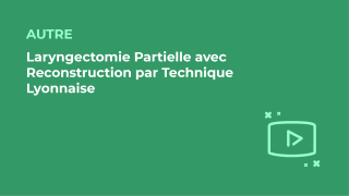 SFORL_VIEWR_video_vignettes-COMMUNAUTEORL3