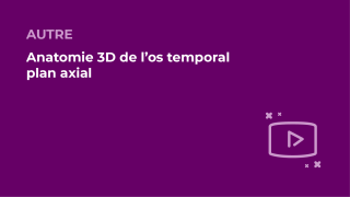 SFORL_VIEWR_video_vignettes-COMMUNAUTEORL87