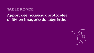 SFORL_VIEWR_video_vignettes-CONGRES_Audiologie-otologie-Oto-neurologie-vertiges5