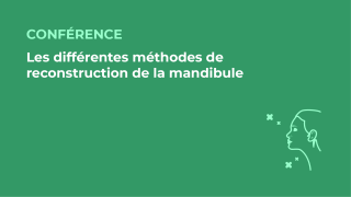 SFORL_VIEWR_video_vignettes-CONGRES_Chirurgie-cervico-faciale-et-Cancerologie84