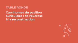 SFORL_VIEWR_video_vignettes-CONGRES_Chirurgie esthetique et reconstructrice6