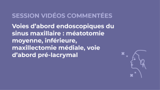 SFORL_VIEWR_video_vignettes-CONGRES_Rhinologie-et-Allergie65